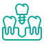Multiple-Tooth Implant Restorations