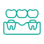 Replacement Teeth for Larger Gaps