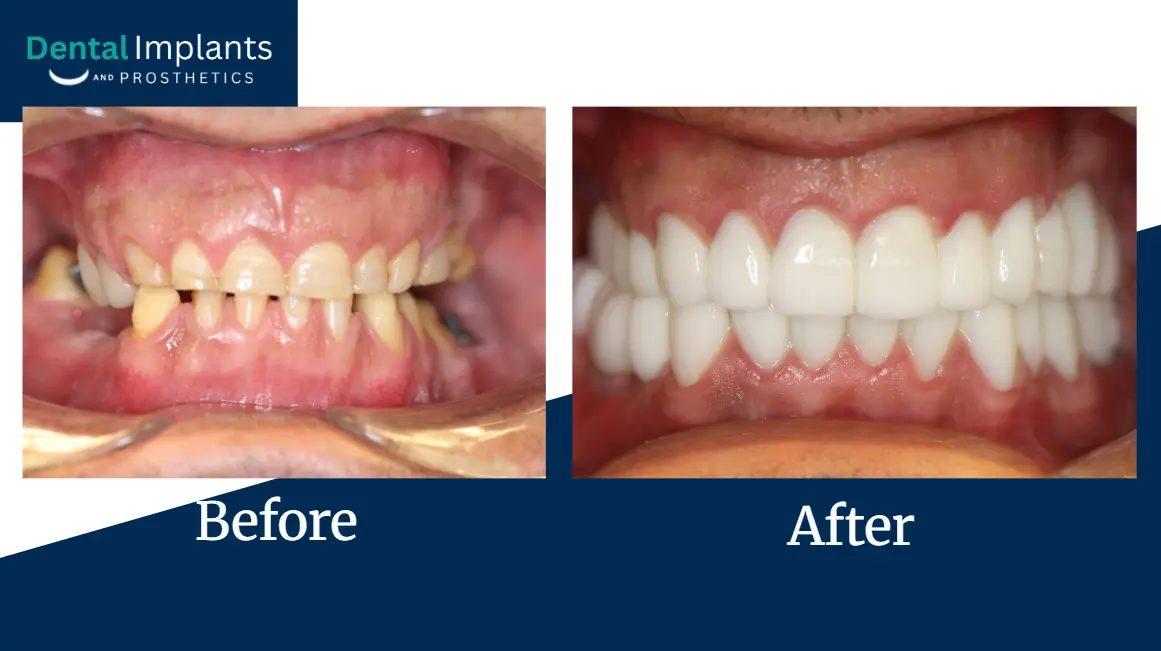 Patient smiling after receiving personalized dental care