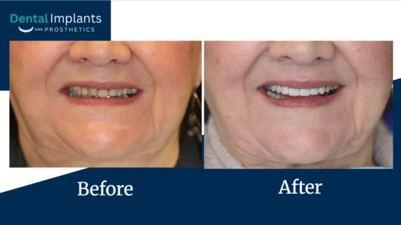 Before After Pptx Google Slides 08 14 2026 03 29 Pmm