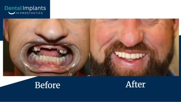 Before After Pptx Google Slides 08 14 2026 03 30 Pm