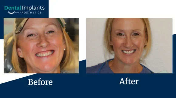 Before After Pptx Google Slides 08 14 2026 03 35 Pm