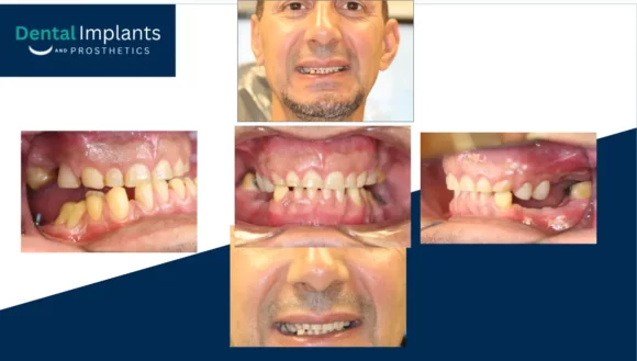 Before After Pptx Google Slides 08 14 2026 03 37 Pm