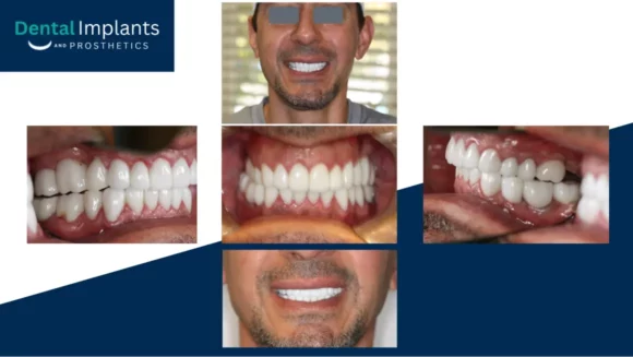 Before After Pptx Google Slides 08 14 2026 03 38 Pm