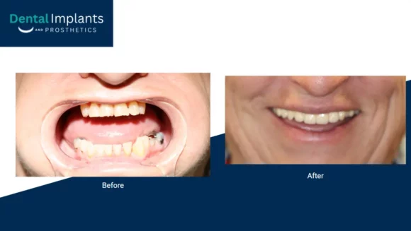 Before After Pptx Google Slides 08 14 2026 03 57 Pmm