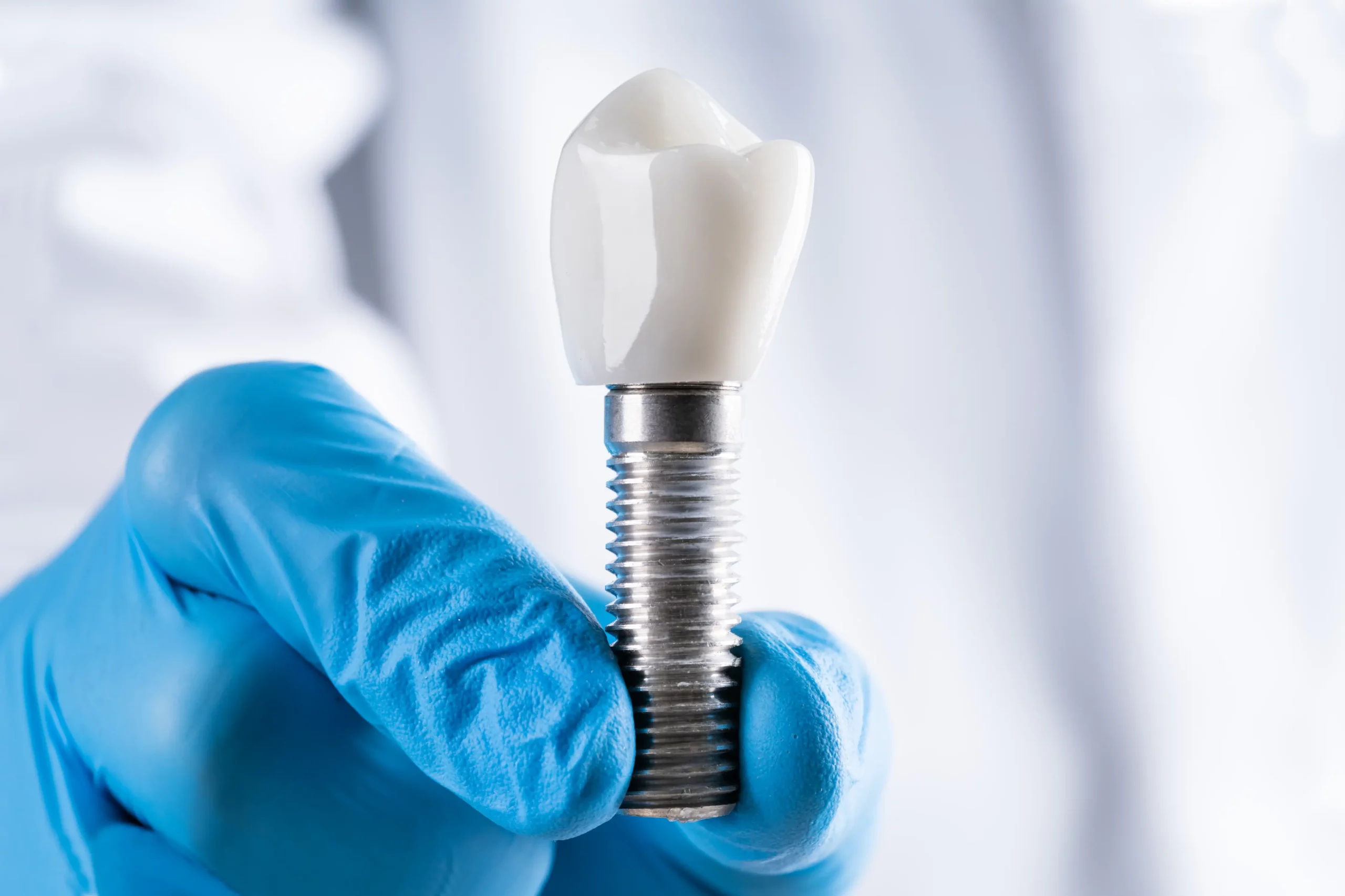 Person in blue gloves holding a screw-in dental implant for restorative treatment
