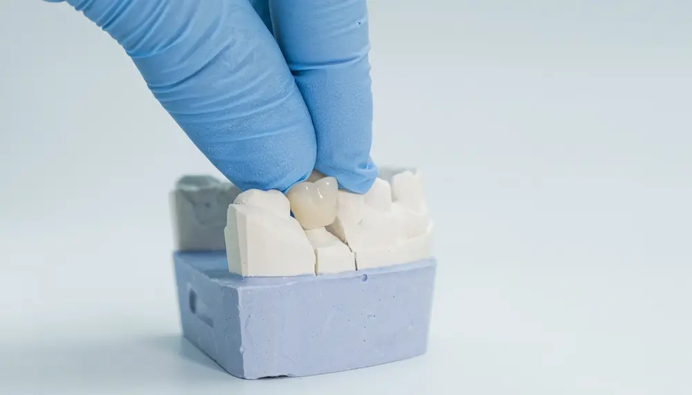 Best Options for Replacing One Missing Tooth